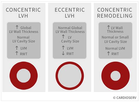 mild concentric lv hypertrophy|mild concentric lv hypertrophy treatment.